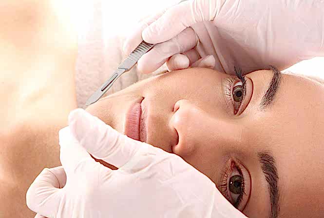 Dermaplaning